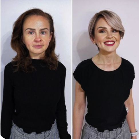 Transformación antes y después 8